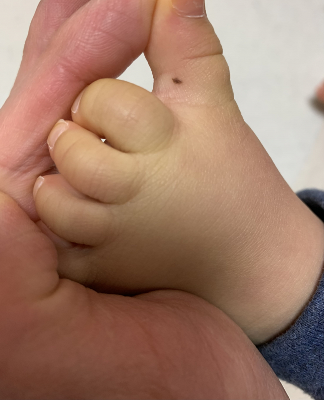 ホクロ占いの写真素材写真素材なら「写真AC」無料 フリー ダウンロードOK