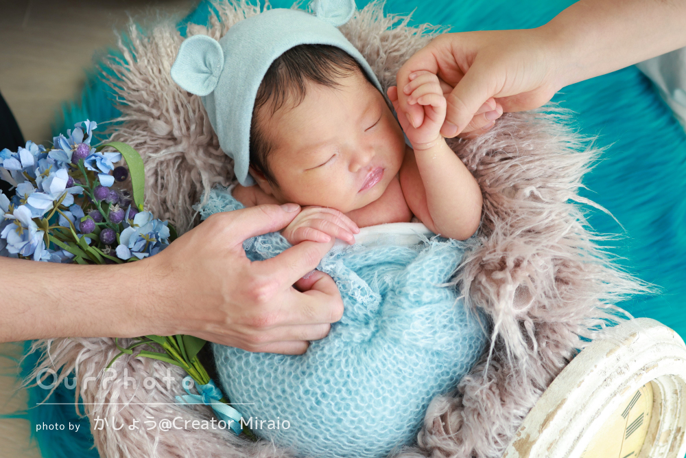 他の赤ちゃんはきれいなのに 」かわいそうと言われ落ち込む。息子の顔を見るたびに ベビーカレンダ