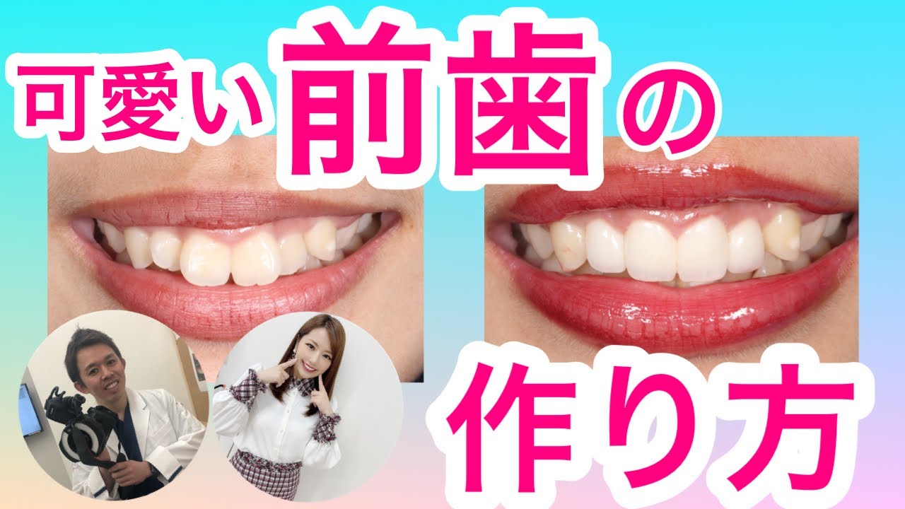 反っ歯、ビーバー歯とは？ 歯並びの特徴やリスクをわかりやすく解説葛西モア矯正歯科葛西駅から徒歩0分・西葛西駅も徒歩圏内・江戸川区の矯正治療専門歯科医院