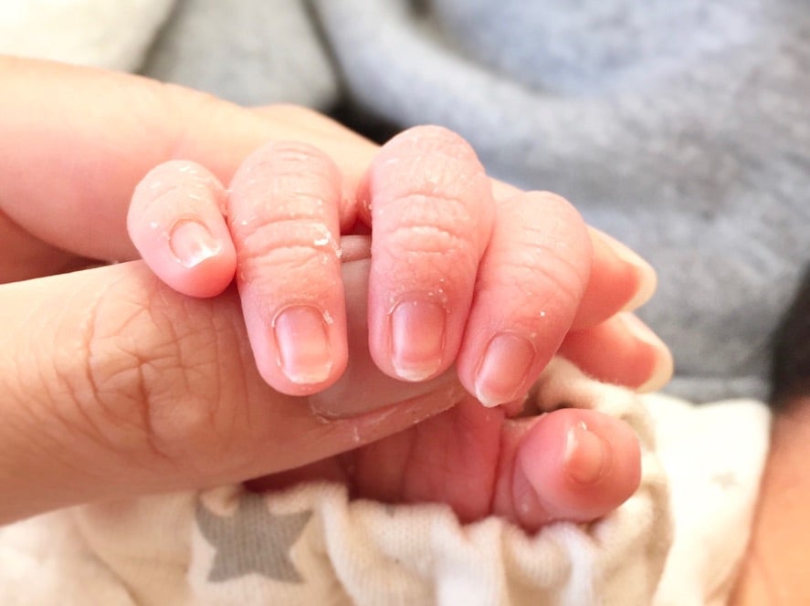 日本人の赤ちゃんの顔で、客観的な「かわいさ」を確認：医療技術ニュース - MONOist