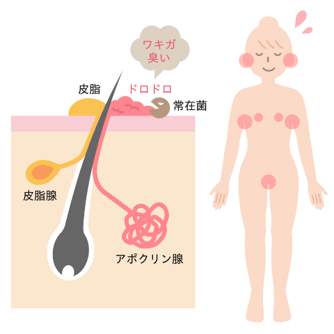 1歳5ヶ月の娘、全身からイカのような臭いがします。 - 赤ちゃん・こどもの症状 - 日本最大級 医師に相談できるQ&Aサイト アスクドクターズ