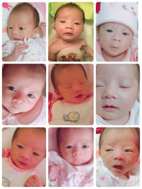 ママパパ必読：赤ちゃんの健やかな睡眠で守る大切ないのち - 関西 赤ちゃんの頭のかたち外来