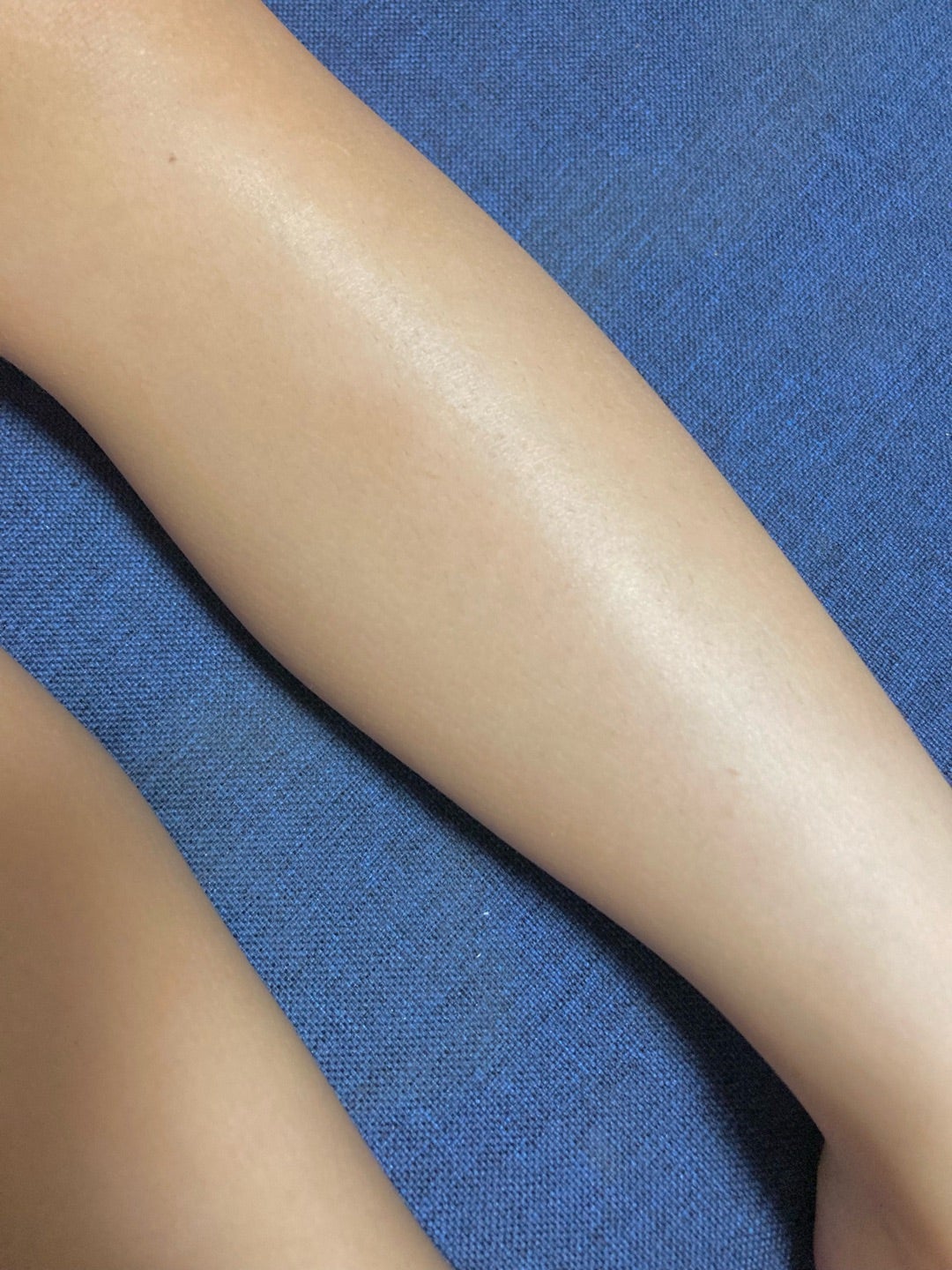 子ども脱毛のメリットとは？3歳から通える脱毛サロンDione ディオーネ