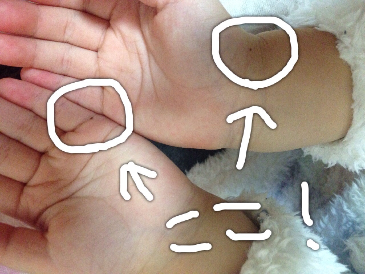 実は凶相! 手のひらの「ほくろ」の意味とは 手相占い 「マイナビウーマン」