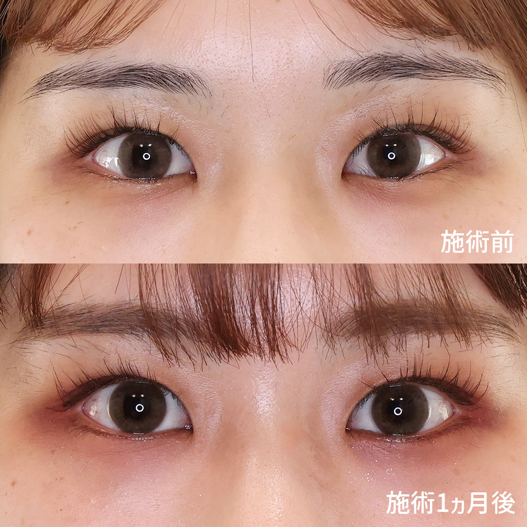 自然でかわいい垂れ目メイクの極意2025 年のリアルなLemon8ユーザー体験