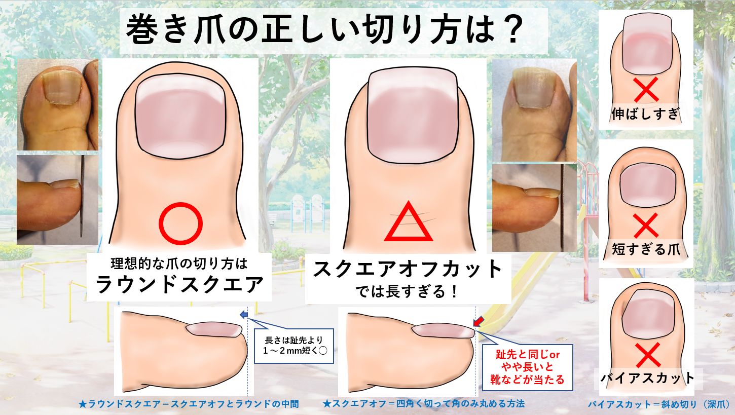 足の指、靴の中で丸まってない？指をのばすと健康になる意外な理由 « 女子SPA