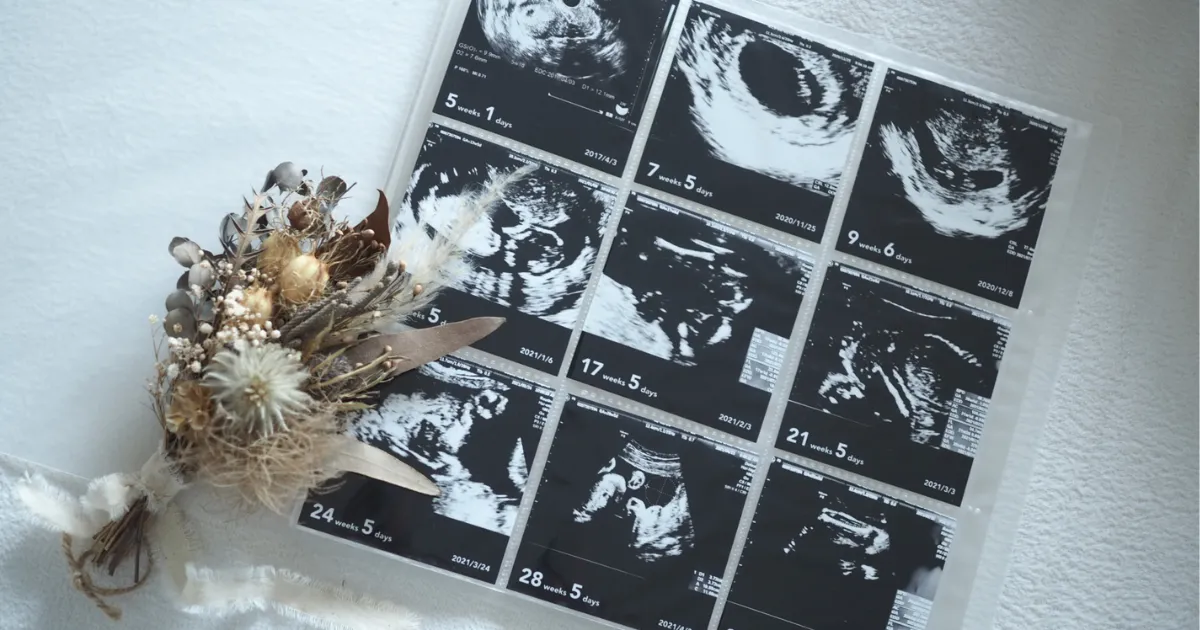 エコー写真を手作りのアルバムに保存したい！作り方や表紙の書き方、素材についてままのて