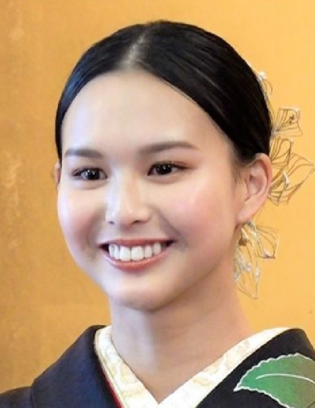 画像 ミイヒの前歯が大きすぎると話題に！昔の方がかわいい！？芸能速報 KATTAN