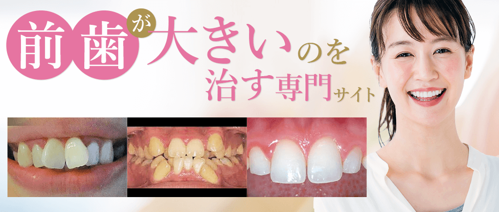 キレイライン矯正で出っ歯は治る？知りたい情報をまとめました公式 キレイライン矯正実績12万人最短2.5ヶ月のマウスピース矯正