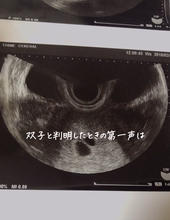 双子の「美人じゃないほう」の私が恋をした 双子が織りなすコンプレックスラブ - 今日のおすすめ講談社