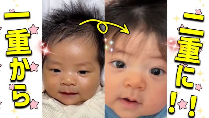 奥二重の特徴二重・目元整形なら湘南美容クリニック 公式