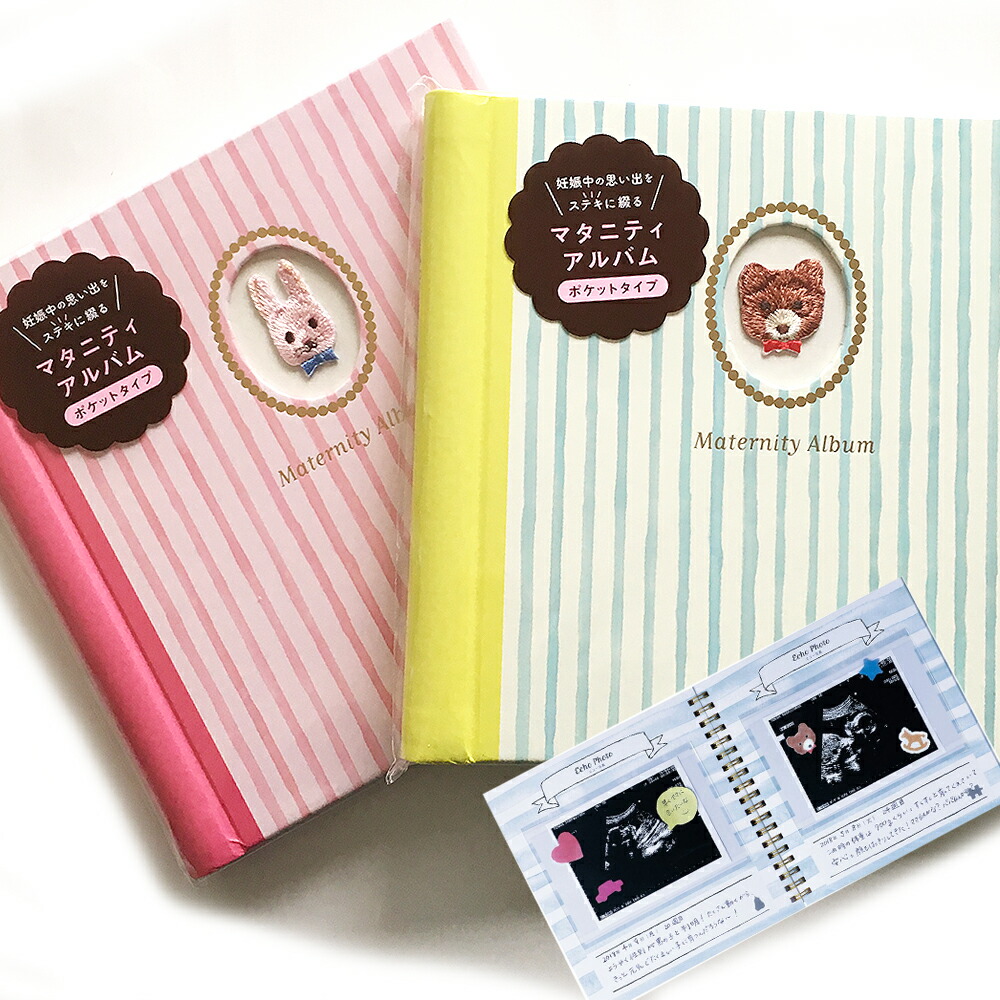 エコー写真をきれいに残そう！保存方法とおすすめアルバム＆アプリ 全プレあり！ cozre コズレ 子育てマガジン