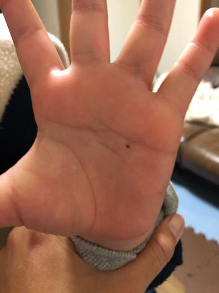 小児科皮膚科福岡市西区の皮膚科・美容皮膚科『九大学研都市かえで皮膚科』糸島市隣