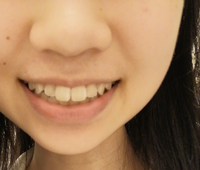 笑顔になれるように 池田瑛紗