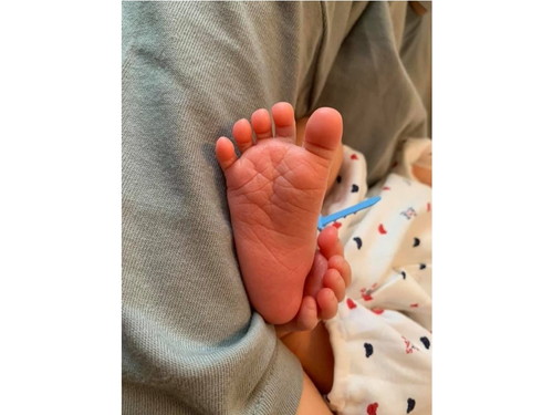 子どもの足の指が丸まっている!? よくある原因と足の指の力を高める方法みやざき足育センタ