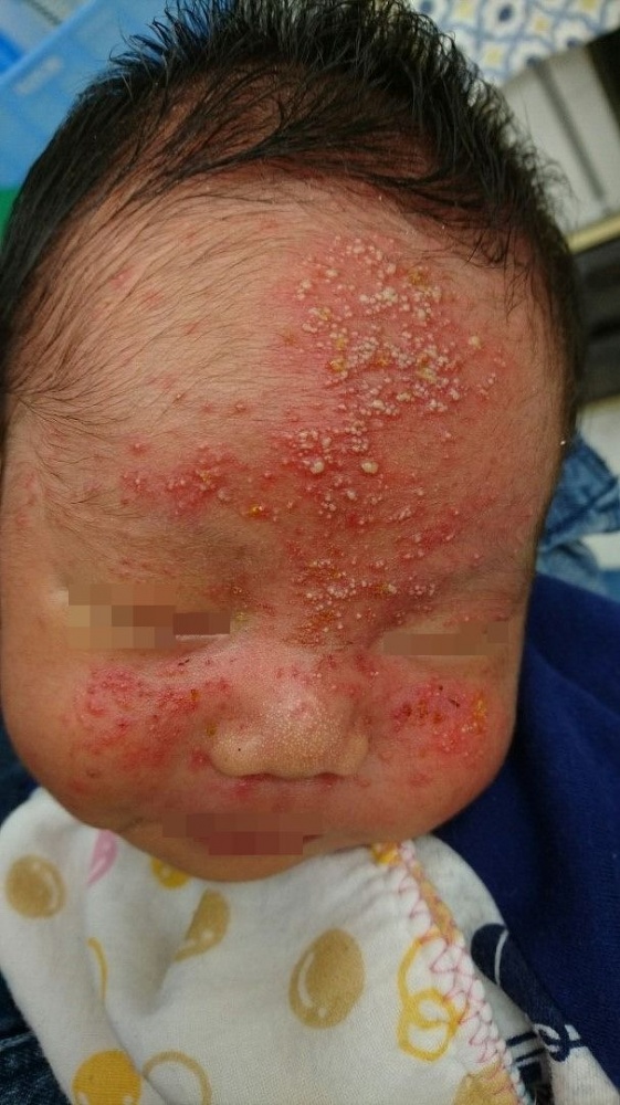 悲報 赤ちゃんの顔が傷だらけになってしまいました,子育てママ子育て育児育児日記育児記録ミトン手袋新生児新生児育児赤ちゃん赤ちゃんのいる生活