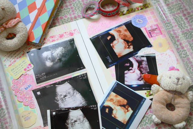 エコー写真のアルバムを手作り！無印とダイソーで手軽に可愛くかおみいログ