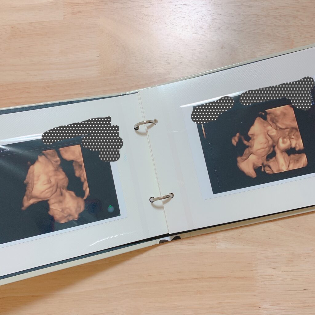 体験談 エコー写真の保存術！アルバム・データ・フォトブックなどみんなの保存方法をご紹介ウーマンエキサイト