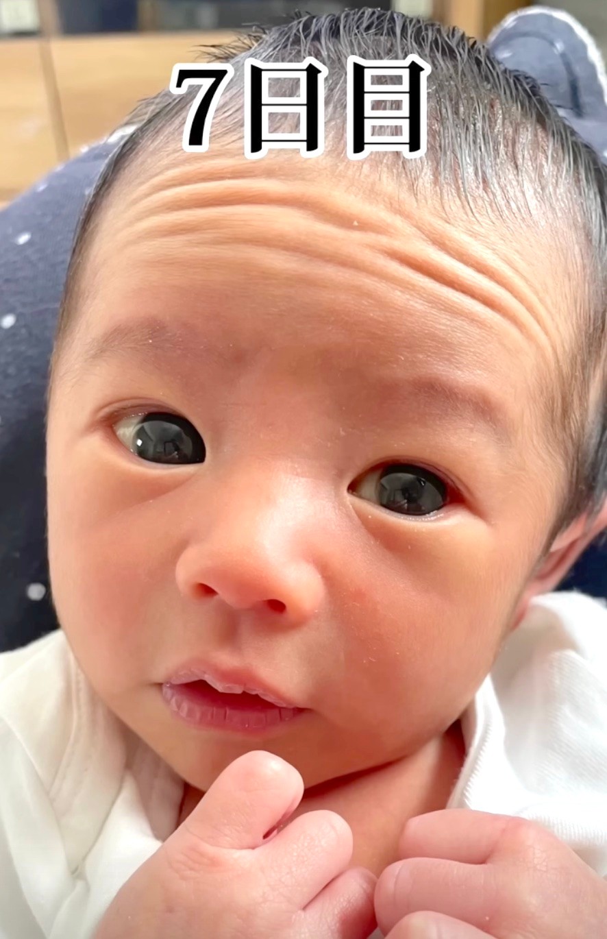 新生児の赤ちゃん、 毎日お顔が変わります👶🏻💗 特に産まれてから退院までの約1週間は 目が開いたり、むくみが取れたり、 どんどんお顔が変化する時期！許可をいただいて 退院までの赤ちゃんのお顔を 記録してみました📸トータルヘルスクリニックトータルヘルス