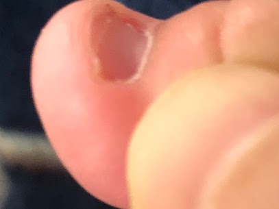 赤ちゃんの手足が青紫色に！？温めるよりも○○が大事助産師みかん🍊赤ちゃん専門家