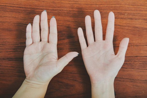 庭のら*のらりくらり:掌に黒子