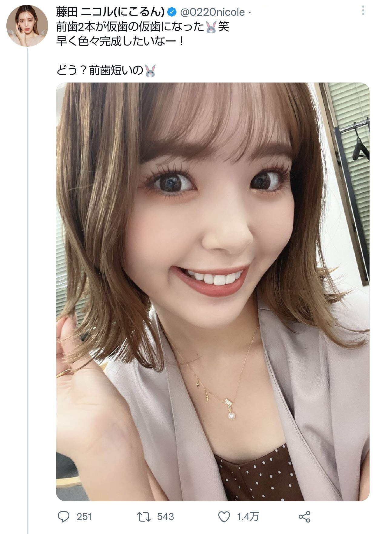 前歯が大きい悩みを解消するセラミッククラウン