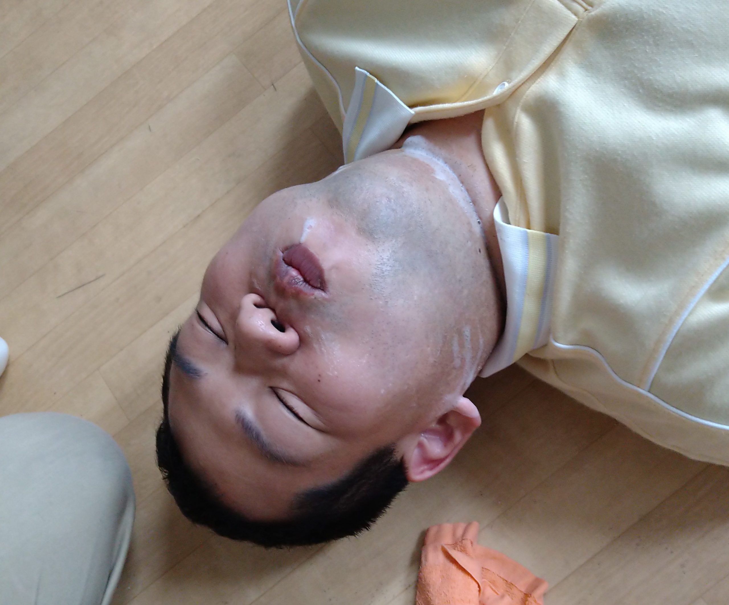 結果を出せる理由 - ゴリラクリニック