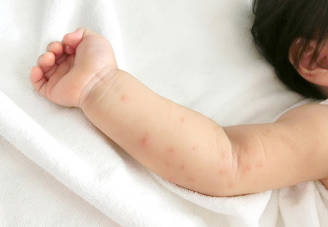 占い師監修 指のほくろが示す意味とは?手足別&左右別のほくろ占い結果