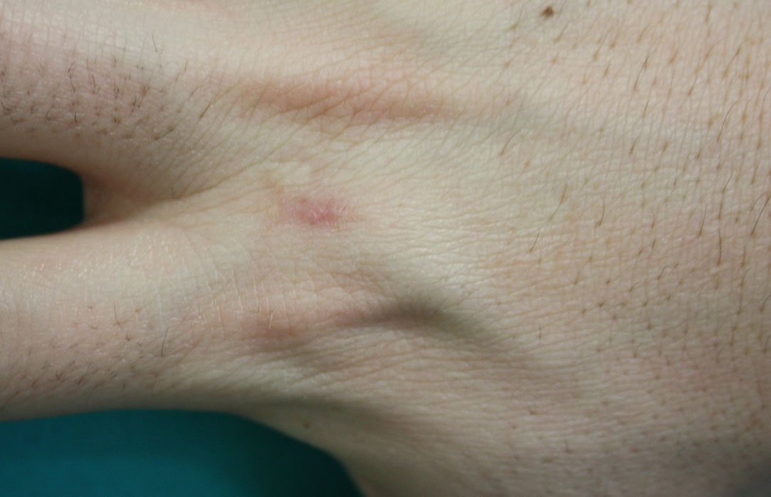 子どもの皮膚疾患について横浜市 東神奈川の神奈川はた皮膚科クリニック