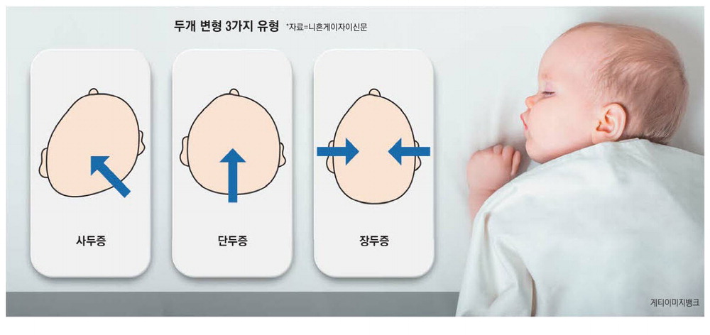 専門医監修 2歳児が手を繋がない理由と発達障害の可能性:親が知っておくべき7つのサイン – 「ふきのこ」放課後等デイサービス・児童発達支援