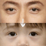 二重になる方法 ダブルアイリキッドAutomatic Beautyの使い方や二重メイク -1年かけて重い一重から二重になった私なりの方法！！ bySORA 20代前半LIPS