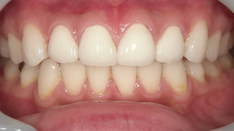 前歯大きい かわいい 知恵袋TikTok