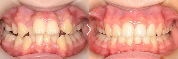 I love Woman's tooth on X: 