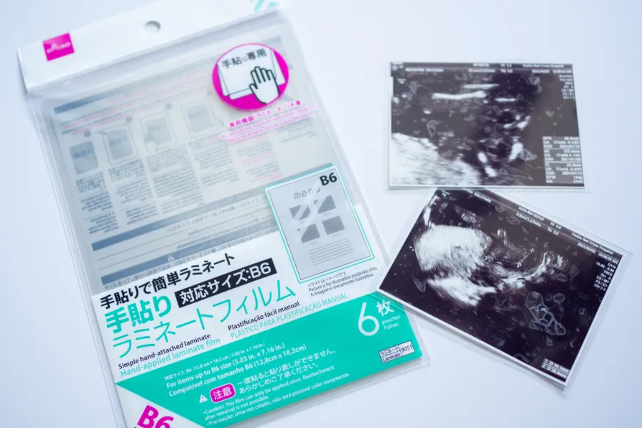 招待コード アルバス＆無印がコスパ最強！エコー写真保存方法３選First Ikujinikki