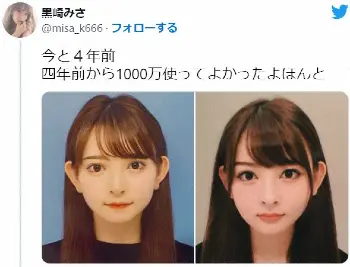 “整形総額2000万超え”黒崎みさ、2億の借金抱えた過去 結婚の決め手・夫婦関係にも迫る＜モデルプレスインタビュー前編＞ - モデルプレス