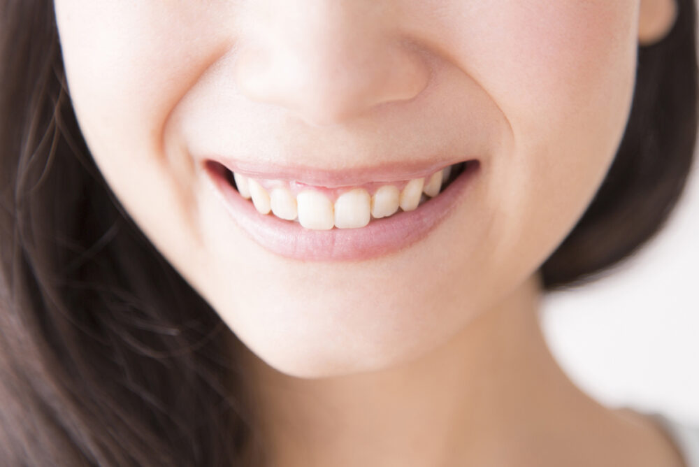 反っ歯、ビーバー歯とは？ 歯並びの特徴やリスクをわかりやすく解説葛西モア矯正歯科葛西駅から徒歩0分・西葛西駅も徒歩圏内・江戸川区の矯正治療専門歯科医院