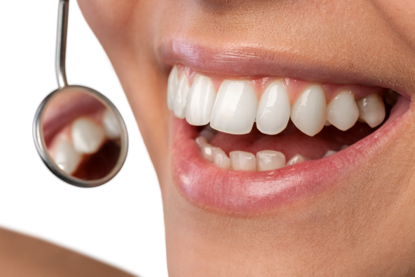 出っ歯でもかわいい人の特徴とは？放置するリスクも解説