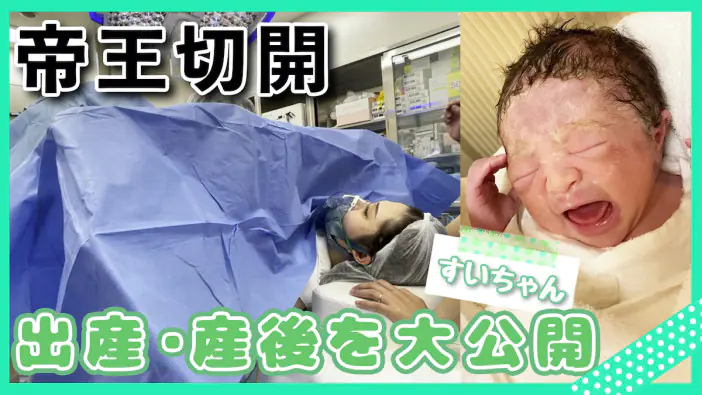 美容系YouTuber・関根りさ、長男が100万人に1人の皮膚の難病に。治療法や薬を必死で探した日々 表皮水疱症・体験談 たまひよ