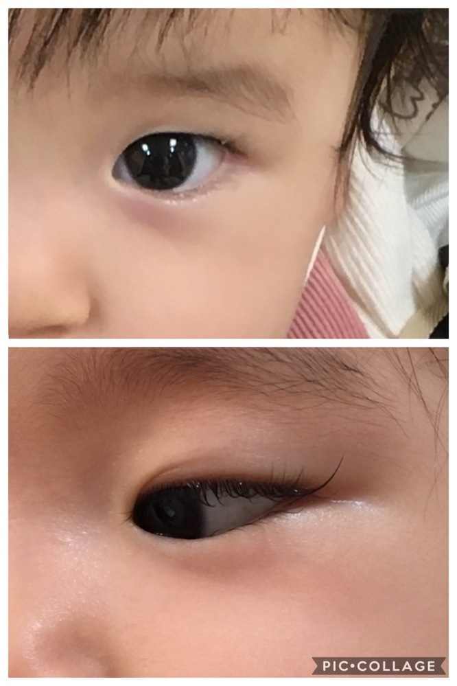 一重のあやさん！女子小学生もついに二重体験！皆さんはどっち