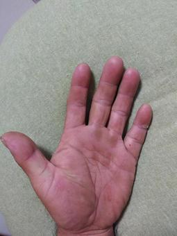 娘の「ほくろ」事情株式会社メイワ