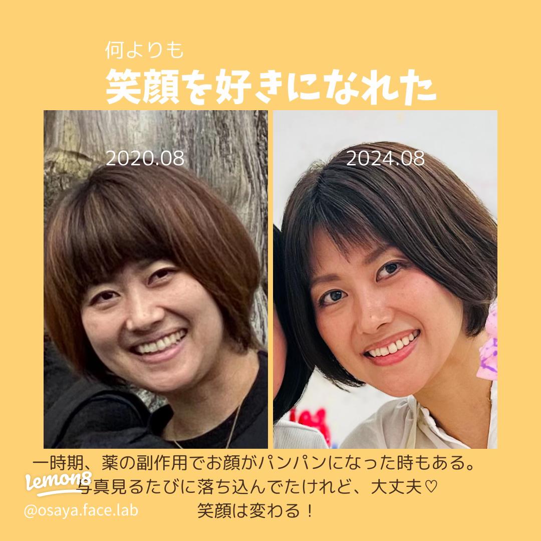 卒アルで輝く笑顔を作る方法自然で魅力的な笑顔のコツとは