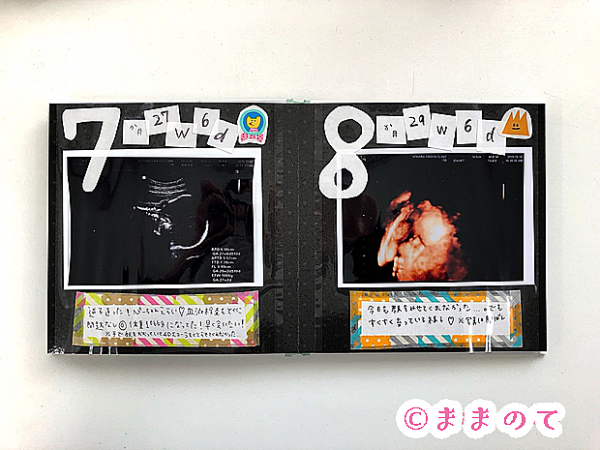 色褪せる前にやっておきたい！ALBUSのましかくプリントでエコー写真を綺麗に残そう。エコーアルバムの作り方RASHIKU