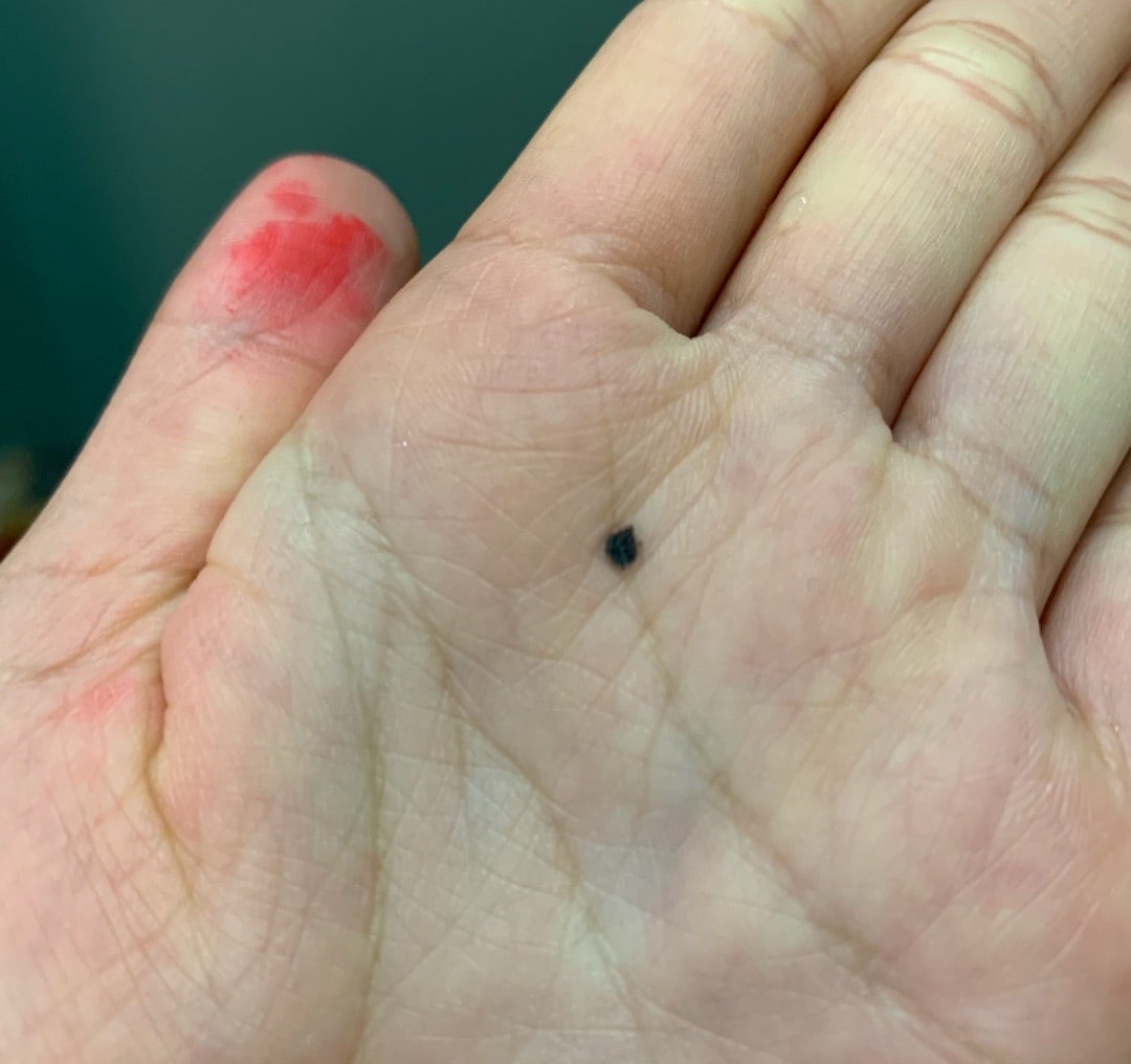 手相のほくろは吉兆?凶兆? 出現位置が中指や薬指などによって違う意味 – grapeグレイプ