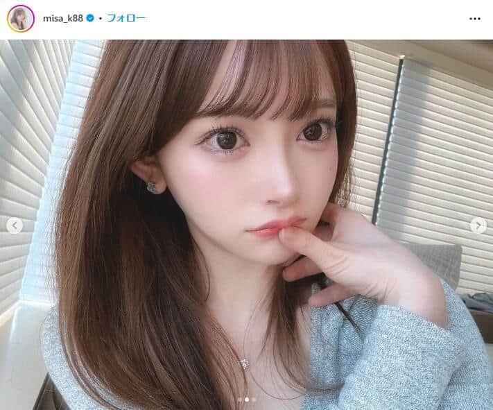 整形美女 「かわいいのになぜ？」黒崎みさが整形に1500万かけた理由「ここを治せば、もっと人生が豊かになると思い込んでた」オリコンニュース ORICON NEWS