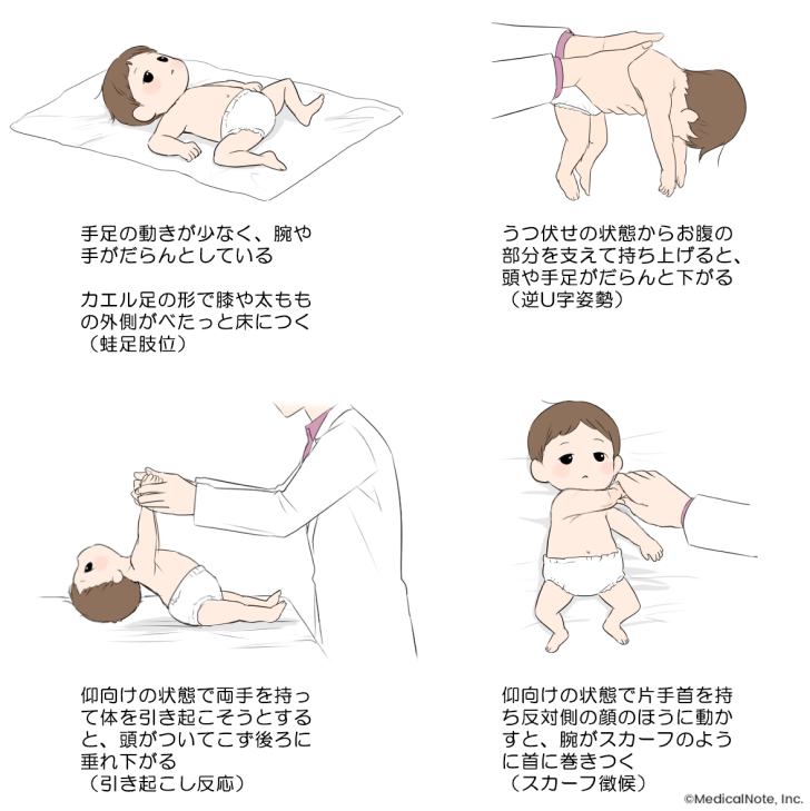 赤ちゃんのお身体ケアレポ👶辻堂・藤沢・横浜・茅ヶ崎 産前産後骨盤矯正・マッサージ・マタニティ専門サロン ルピナス