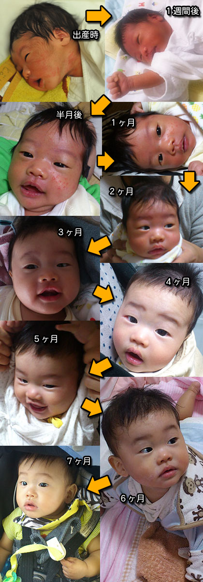 子供 日本とペルーの赤ちゃんの顔の変化女の子3歳まで - たまごんブログ