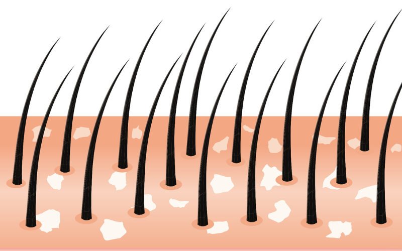 中学生、男児の頭が臭い。おススメのシャンプー教えて。生活・身近な話題発言小町