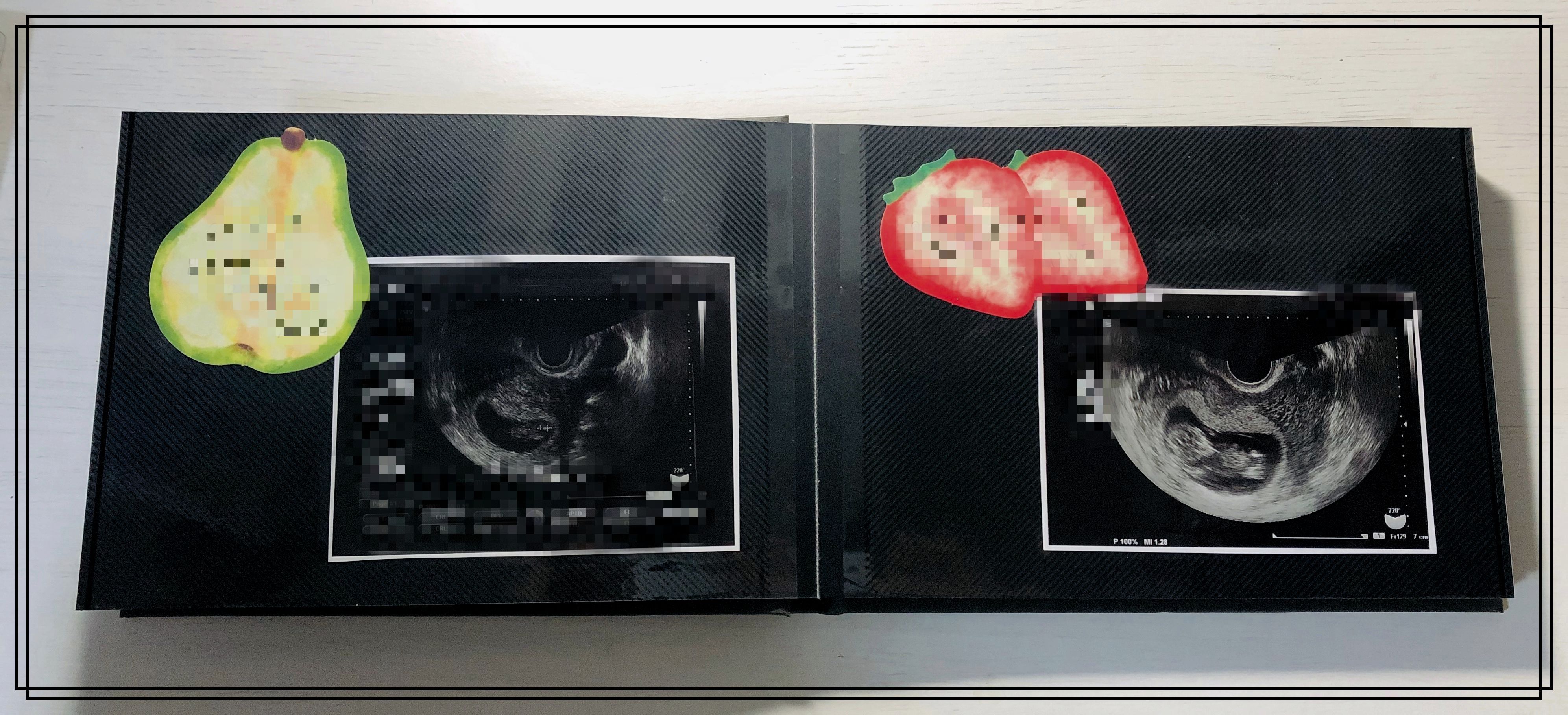 エコーアルバム 手作り 無印TikTok