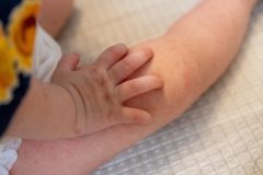 手相のほくろは吉兆?凶兆? 出現位置が中指や薬指などによって違う意味 – grapeグレイプ