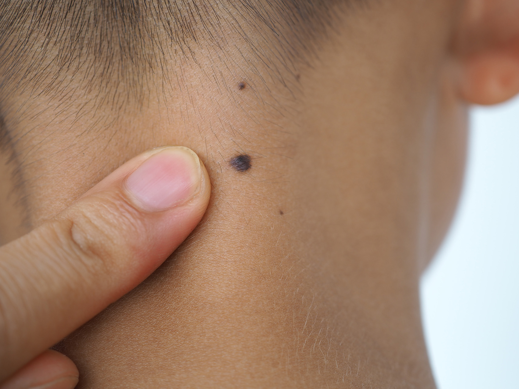 手相占い 手のひらにホクロがある人は要注意。位置によって対策を卯野たまごの空気を読まず手相を読むmi-mollet ミモレ明日の私へ、小さな一歩! 2 2